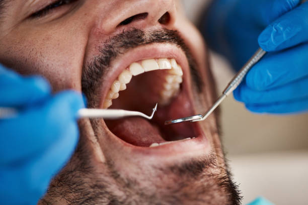 Best Emergency Wisdom Teeth Removal in Cera, AL