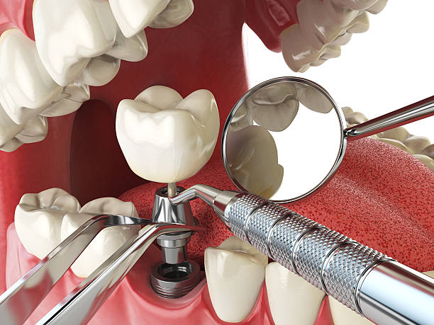 Best Emergency Treatment for Toothache in Cera, AL